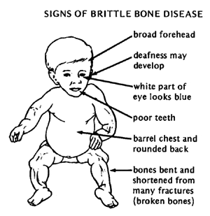 osteogenesis imperfecta