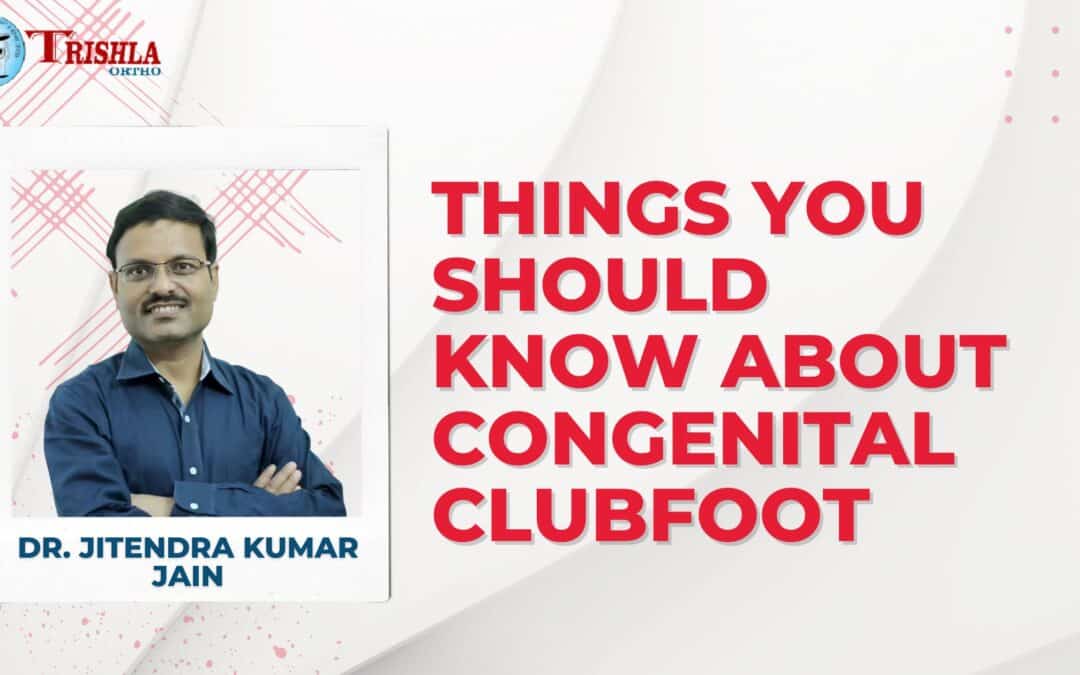 Things You Should Know about Congenital Clubfoot