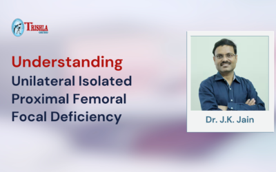 Understanding Unilateral Isolated Proximal Femoral Focal Deficiency