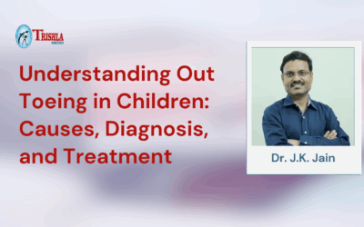 Understanding Out Toeing in Children: Causes, Diagnosis, and Treatment