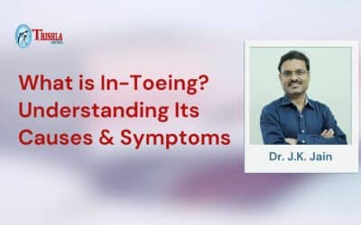 What is In-Toeing? Understanding Its Causes & Symptoms