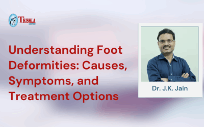 Understanding Foot Deformities: Causes, Symptoms, and Treatment Options