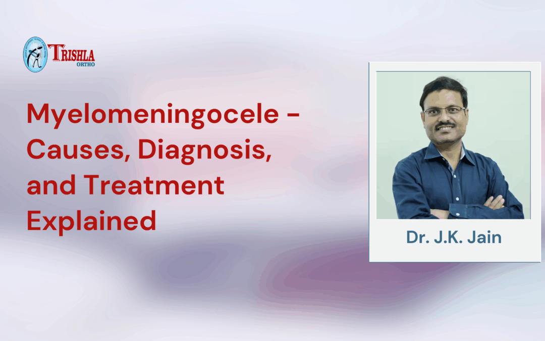 Myelomeningocele – Causes, Diagnosis, and Treatment Explained