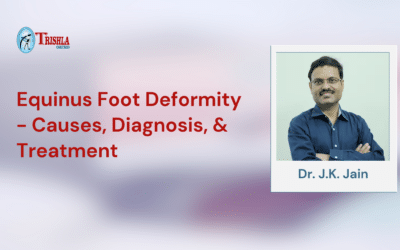 Equinus Foot Deformity – Causes, Diagnosis, and Treatment Options