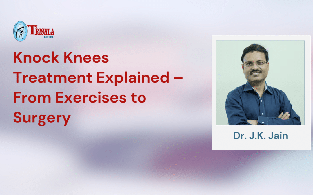 Knock Knees Treatment Explained – From Exercises to Surgery