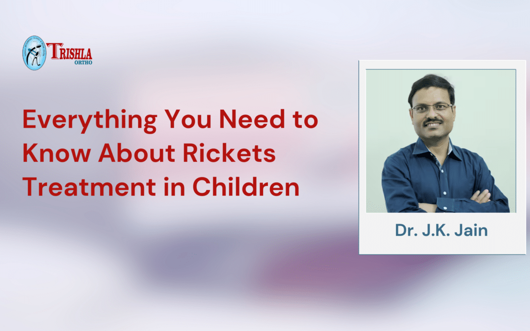 Everything You Need to Know about Rickets Treatment in Children