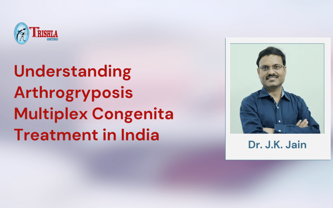 Understanding Arthrogryposis Multiplex Congenita Treatment in India