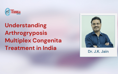 Understanding Arthrogryposis Multiplex Congenita Treatment in India