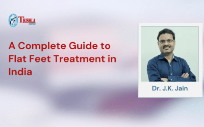 A Complete Guide to Flat Feet Treatment in India