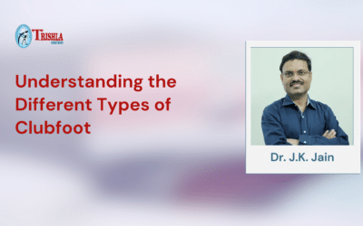 Understanding the Different Types of Clubfoot