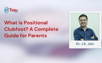 What is Positional Clubfoot? A Complete Guide for Parents