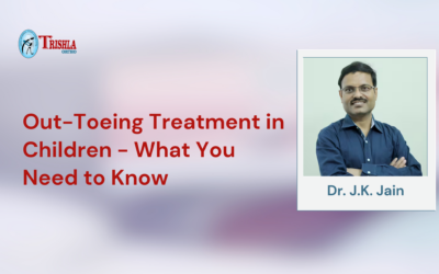 Out-Toeing Treatment in Children – What You Need to Know